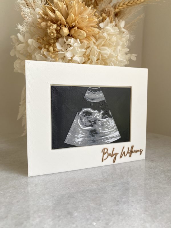 Personalised Framed 3D Sonogram - Image 2
