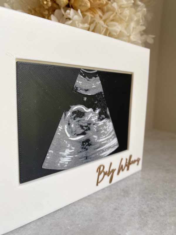 Personalised Framed 3D Sonogram - Image 3