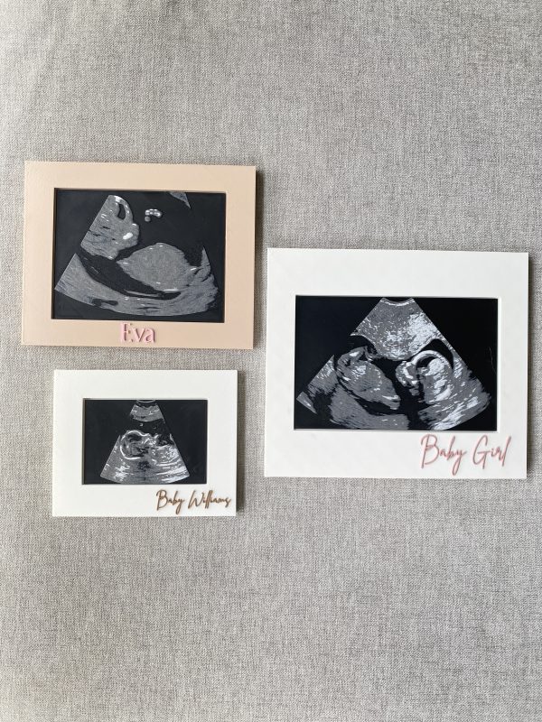 Personalised Framed 3D Sonogram - Image 4