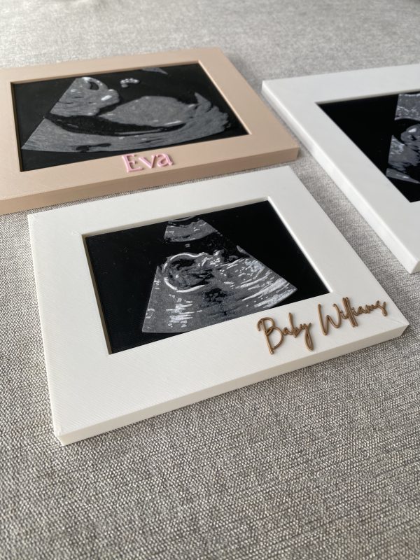 Personalised Framed 3D Sonogram - Image 5